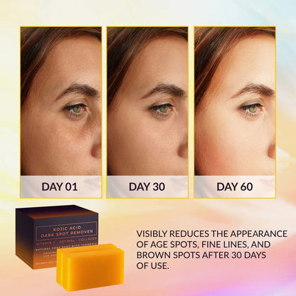VALITIC Kojisäure Seifenstücke gegen dunkle Flecken mit Vitamin C, Retinol, Kollagen, Kurkuma